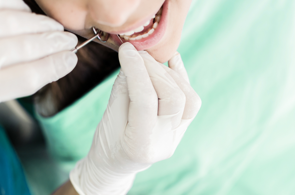 Understanding Root Canal Cracked Tooth | Your Dental Guide