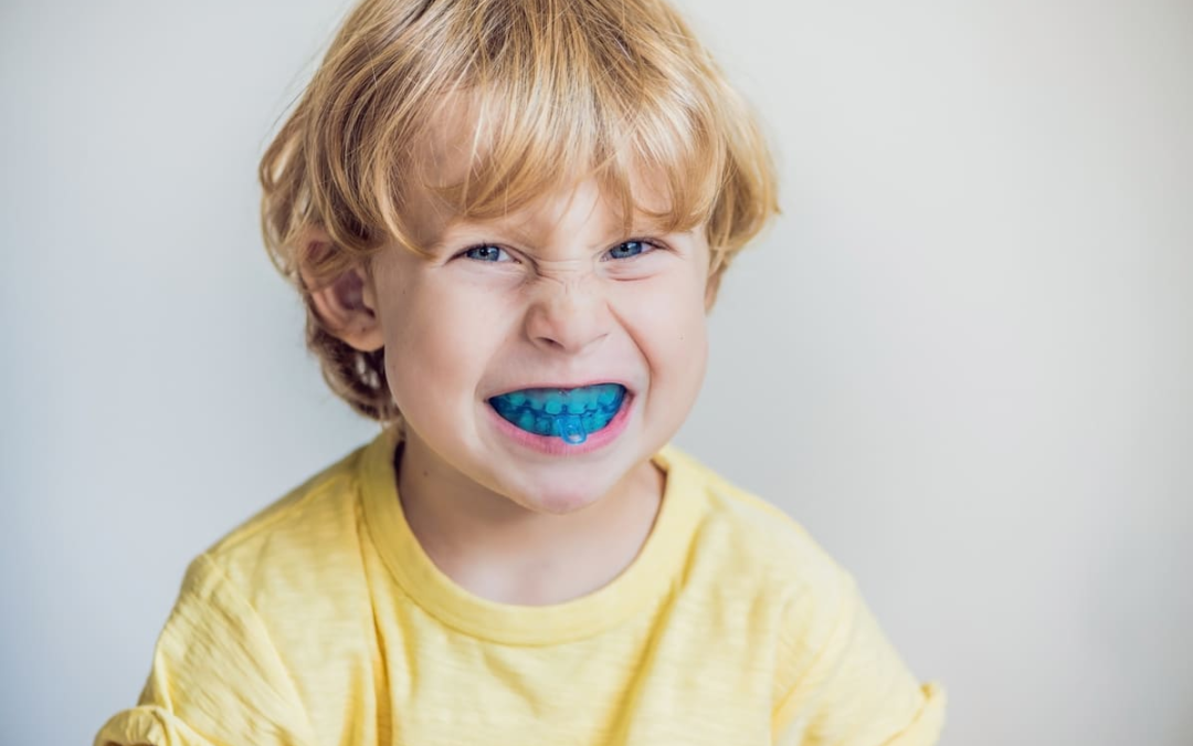 teeth grinding in children sydney